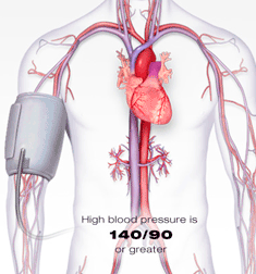 High Blood Pressure